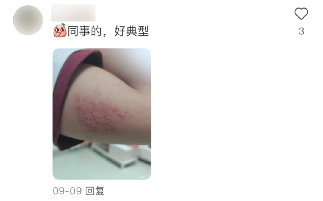 一旦感染终身携带<strong></p>
<p>TradeSatoshi</strong>！深圳疾控提醒：这4类人要注意