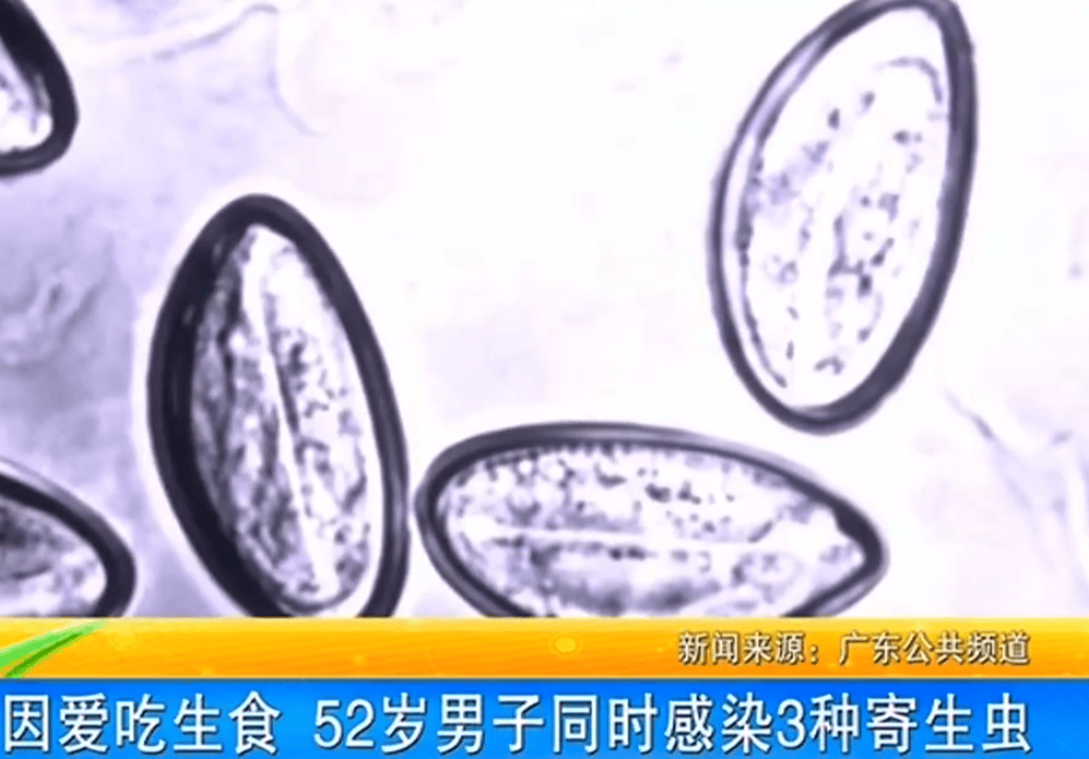 女子体内排出10米长绦虫<strong></p>
<p>ZIBIT</strong>！原是两年前旅游时吃了这种食物